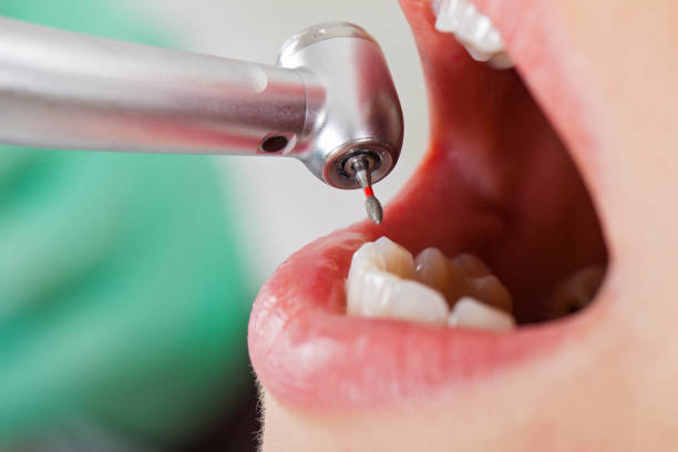 Urgent Tooth Repair in HI